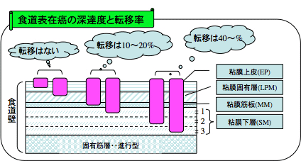 図11