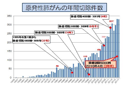 原発性肺がんの年間切除数