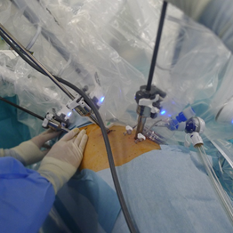 ロボット支援下手術