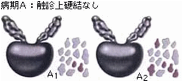�a��A