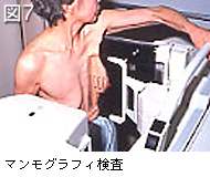 図7 マンモグラフィ検査