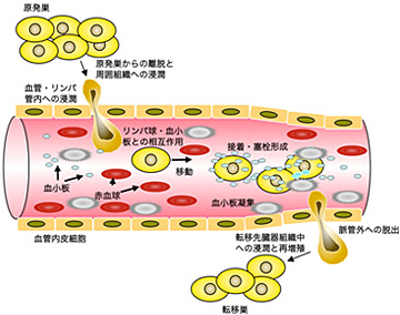 がん転移分子機構の解明とそれに基づく創薬|研究内容|がん化学療法センター