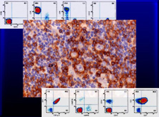 Fig.2: Immunohistchemistry and Flowcytometry