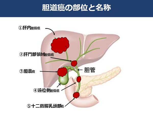 痛み 肝臓 場所 ん が