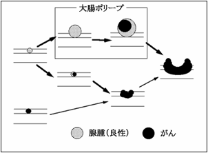 大腸がん｜がんに関する情報｜がん研有明病院