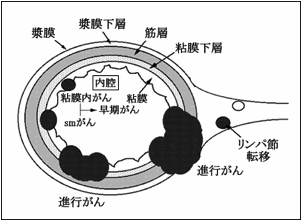 }F咰