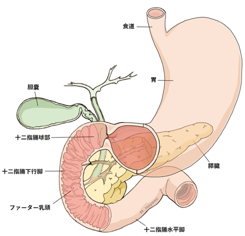 十二指腸 閉鎖 ダウン症 じゃ なかっ た