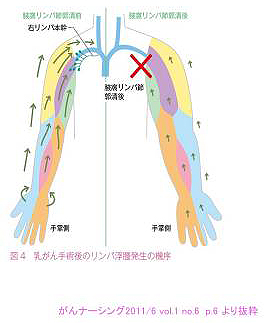 リンパ 鎖骨 節 上 鎖骨上窩リンパ節