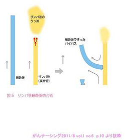 リンパ浮腫治療室とは リンパ浮腫治療室 がん研有明病院