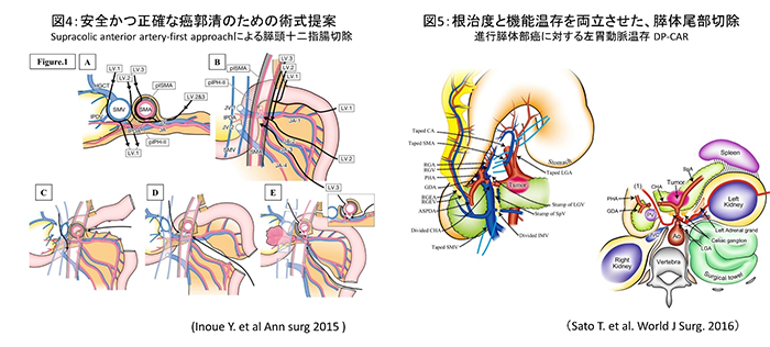 肝・胆・膵外科