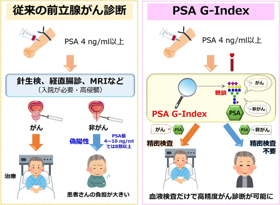 プレスリリース 前立腺がん診断の精度を飛躍的に高めることが可能な血液検査バイオマーカー Psa G Index を開発 新着情報 がん研究所